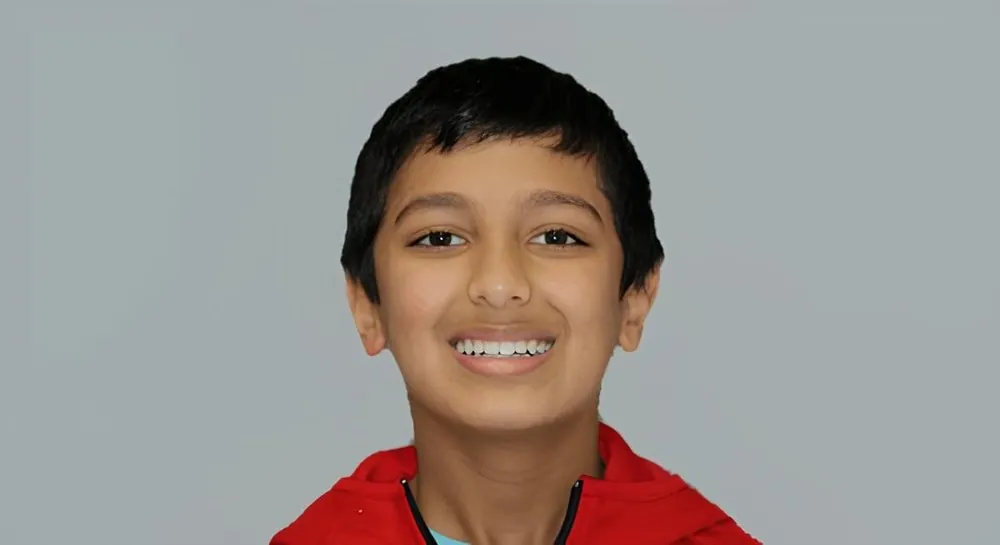 Orthodontic alignment in a child, case 7: before and after, after
